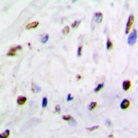 QKI Antibody - Immunohistochemical analysis of QKI staining in mouse brain formalin fixed paraffin embedded tissue section. The section was pre-treated using heat mediated antigen retrieval with sodium citrate buffer (pH 6.0). The section was then incubated with the antibody at room temperature and detected using an HRP conjugated compact polymer system. DAB was used as the chromogen. The section was then counterstained with hematoxylin and mounted with DPX.