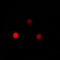 QKI Antibody - Immunofluorescent analysis of QKI staining in MCF7 cells. Formalin-fixed cells were permeabilized with 0.1% Triton X-100 in TBS for 5-10 minutes and blocked with 3% BSA-PBS for 30 minutes at room temperature. Cells were probed with the primary antibody in 3% BSA-PBS and incubated overnight at 4 deg C in a humidified chamber. Cells were washed with PBST and incubated with a DyLight 594-conjugated secondary antibody (red) in PBS at room temperature in the dark.