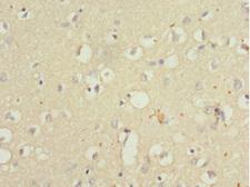 QKI Antibody - Immunohistochemistry of paraffin-embedded human brain tissue at dilution 1:100