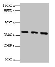 QKI Antibody - Western blot All Lanes:QKI antibody at 1.92ug/ml Lane 1:HL-60 whole cell lysate Lane 2:Hela whole cell lysate Lane 3:K562 whole cell lysate Secondary Goat polyclonal to rabbit at 1/10000 dilution Predicted band size: 38,37,36 kDa Observed band size: 38 kDa,70 kDa