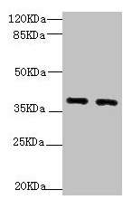 QKI Antibody - Western blot All lanes: QKI antibody at 1.92µg/ml Lane 1: HL60 whole cell lysate Lane 2: K562 whole cell lysate Secondary Goat polyclonal to rabbit IgG at 1/10000 dilution Predicted band size: 38, 37, 36 kDa Observed band size: 38, 70 kDa