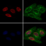 QKI Antibody - Staining HeLa cells by IF/ICC. The samples were fixed with PFA and permeabilized in 0.1% Triton X-100, then blocked in 10% serum for 45 min at 25°C. Samples were then incubated with primary Ab(1:200) and mouse anti-beta tubulin Ab(1:200) for 1 hour at 37°C. An AlexaFluor594 conjugated goat anti-rabbit IgG(H+L) Ab(1:200 Red) and an AlexaFluor488 conjugated goat anti-mouse IgG(H+L) Ab(1:600 Green) were used as the secondary antibod