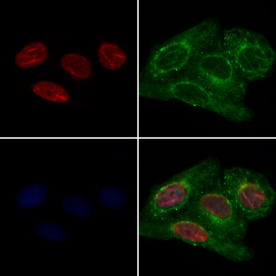 QKI Antibody - Staining HeLa cells by IF/ICC. The samples were fixed with PFA and permeabilized in 0.1% Triton X-100, then blocked in 10% serum for 45 min at 25°C. Samples were then incubated with primary Ab(1:200) and mouse anti-beta tubulin Ab(1:200) for 1 hour at 37°C. An AlexaFluor594 conjugated goat anti-rabbit IgG(H+L) Ab(1:200 Red) and an AlexaFluor488 conjugated goat anti-mouse IgG(H+L) Ab(1:600 Green) were used as the secondary antibod