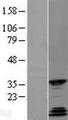 QKI Protein - Western validation with an anti-DDK antibody * L: Control HEK293 lysate R: Over-expression lysate