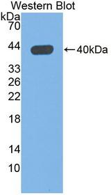 QPCT / QC Antibody - Western blot of QPCT / QC antibody.