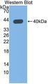 QPCT / QC Antibody - Western blot of QPCT / QC antibody.