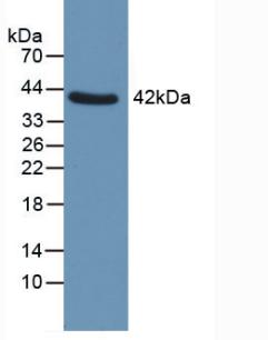 QPCT / QC Antibody - Western Blot; Sample: Human Uterus.