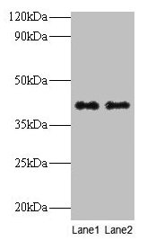 QPCT / QC Antibody - Western blot All lanes: Actin, cytoplasmic 1 antibody at 2µg/ml Lane 1: Rat sex gland tissue Lane 2: Rat suprarenal glandSecondary Goat polyclonal to rabbit IgG at 1/10000 dilution Predicted band size: 41, 36 kDa Observed band size: 41 kDa