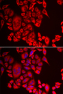 QPCT / QC Antibody - Immunofluorescence analysis of MCF-7 cells.