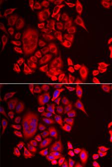 QPCT / QC Antibody - Immunofluorescence analysis of MCF-7 cells.