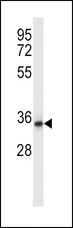 QPRT Antibody - QPRT Antibody western blot of human placenta tissue lysates (35 ug/lane). The QPRT antibody detected the QPRT protein (arrow).