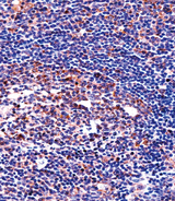 QPRT Antibody - QPRT Antibody immunohistochemistry of formalin-fixed and paraffin-embedded human tonsil tissue followed by peroxidase-conjugated secondary antibody and DAB staining.