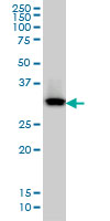 QPRT Antibody - QPRT monoclonal antibody (M01), clone 5D11 Western blot of QPRT expression in HepG2.