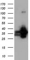 QPRT Antibody - HEK293T cells were transfected with the pCMV6-ENTRY control (Left lane) or pCMV6-ENTRY QPRT (Right lane) cDNA for 48 hrs and lysed. Equivalent amounts of cell lysates (5 ug per lane) were separated by SDS-PAGE and immunoblotted with anti-QPRT.
