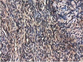 QPRT Antibody - IHC of paraffin-embedded Human endometrium tissue using anti-QPRT mouse monoclonal antibody.