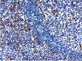 QPRT Antibody - IHC of paraffin-embedded Human lymph node tissue using anti-QPRT mouse monoclonal antibody.