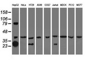 QPRT Antibody - Western blot of extracts (35 ug) from 9 different cell lines by using anti-QPRT monoclonal antibody.