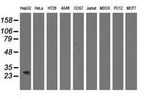 QPRT Antibody - Western blot analysis of extracts (35ug) from 9 different cell lines by using anti-QPRT monoclonal antibody.