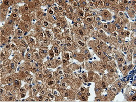 QPRT Antibody - Immunohistochemical staining of paraffin-embedded Human liver tissue using anti-QPRT mouse monoclonal antibody.