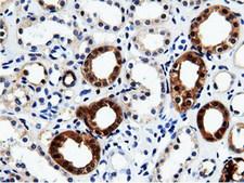 QPRT Antibody - IHC of paraffin-embedded Human Kidney tissue using anti-QPRT mouse monoclonal antibody.