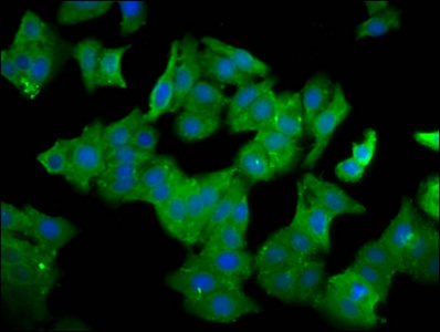 QPRT Antibody - Immunofluorescence staining of HepG2 cells diluted at 1:100, counter-stained with DAPI. The cells were fixed in 4% formaldehyde, permeabilized using 0.2% Triton X-100 and blocked in 10% normal Goat Serum. The cells were then incubated with the antibody overnight at 4°C.The Secondary antibody was Alexa Fluor 488-congugated AffiniPure Goat Anti-Rabbit IgG (H+L).