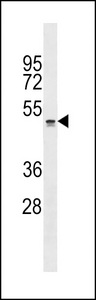 QRFPR / GPR103 Antibody - QRFPR Antibody western blot of NCI-H460 cell line lysates (35 ug/lane). The QRFPR antibody detected the QRFPR protein (arrow).