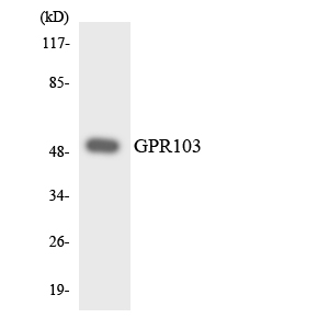 QRFPR / GPR103 Antibody - Western blot analysis of the lysates from Jurkat cells using GPR103 antibody.