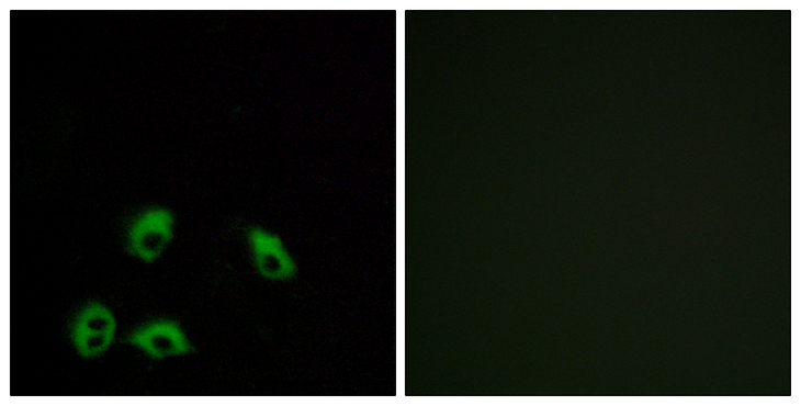 QRFPR / GPR103 Antibody - Immunofluorescence analysis of MCF7 cells, using GPR103 Antibody. The picture on the right is blocked with the synthesized peptide.