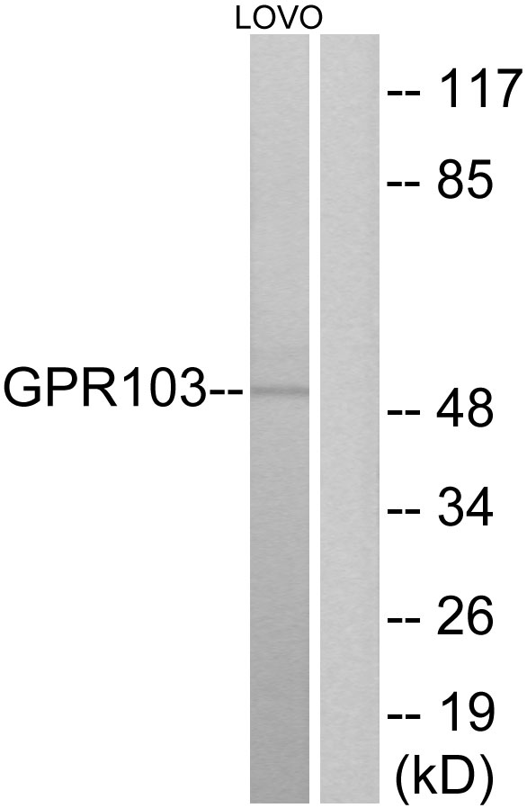 QRFPR / GPR103 Antibody - Western blot analysis of lysates from LOVO cells, using GPR103 Antibody. The lane on the right is blocked with the synthesized peptide.