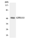 QRFPR / GPR103 Antibody - Western blot analysis of the lysates from HUVECcells using GPR103 antibody.