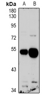 QRFPR / GPR103 Antibody - Western blot analysis of GPR103 expression in U87MG (A), HEK293T (B) whole cell lysates.
