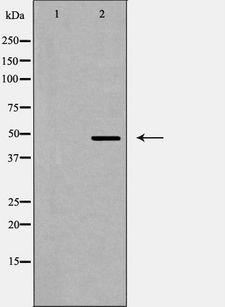 QRFPR / GPR103 Antibody - Western blot analysis of GPR103 expression in LOVO cells. The lane on the left is treated with the antigen-specific peptide.