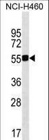 QRSL1 / GatA Antibody - QRSL1 Antibody western blot of NCI-H460 cell line lysates (35 ug/lane). The QRSL1 antibody detected the QRSL1 protein (arrow).