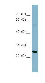 QRSL1 / GatA Antibody - QRSL1 antibody Western blot of HT1080 cell lysate. This image was taken for the unconjugated form of this product. Other forms have not been tested.
