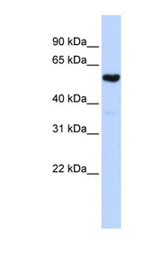 QRSL1 / GatA Antibody - QRSL1 antibody Western blot of Fetal Brain lysate. This image was taken for the unconjugated form of this product. Other forms have not been tested.