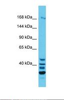 QSER1 Antibody - Western blot of Human HepG2. QSER1 antibody dilution 1.0 ug/ml.  This image was taken for the unconjugated form of this product. Other forms have not been tested.