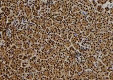 QSER1 Antibody - 1:100 staining mouse kidney tissue by IHC-P. The sample was formaldehyde fixed and a heat mediated antigen retrieval step in citrate buffer was performed. The sample was then blocked and incubated with the antibody for 1.5 hours at 22°C. An HRP conjugated goat anti-rabbit antibody was used as the secondary.