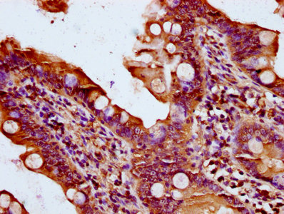 QSOX1 / QSCN6 Antibody - Immunohistochemistry Dilution at 1:400 and staining in paraffin-embedded human small intestine tissue performed on a Leica BondTM system. After dewaxing and hydration, antigen retrieval was mediated by high pressure in a citrate buffer (pH 6.0). Section was blocked with 10% normal Goat serum 30min at RT. Then primary antibody (1% BSA) was incubated at 4°C overnight. The primary is detected by a biotinylated Secondary antibody and visualized using an HRP conjugated SP system.