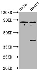 QSOX1 / QSCN6 Antibody - Western Blot Positive WB detected in: Hela whole cell lysate, Rat heart tissue All Lanes: QSOX1 antibody at 5.6µg/ml Secondary Goat polyclonal to rabbit IgG at 1/50000 dilution Predicted band size: 83 KDa Observed band size: 83 KDa