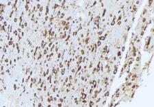 QSOX1 / QSCN6 Antibody - 1:100 staining mouse brain tissue by IHC-P. The sample was formaldehyde fixed and a heat mediated antigen retrieval step in citrate buffer was performed. The sample was then blocked and incubated with the antibody for 1.5 hours at 22°C. An HRP conjugated goat anti-rabbit antibody was used as the secondary.