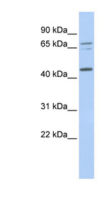QTRT1 Antibody - QTRT1 antibody Western blot of MCF7 cell lysate. This image was taken for the unconjugated form of this product. Other forms have not been tested.