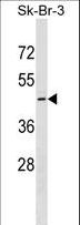 QTRT1 Antibody - QTRT1 Antibody western blot of SK-BR-3 cell line lysates (35 ug/lane). The QTRT1 antibody detected the QTRT1 protein (arrow).