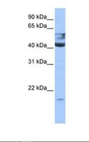 QTRT1 Antibody - Fetal brain cell lysate. Antibody concentration: 0.5 ug/ml. Gel concentration: 12%.  This image was taken for the unconjugated form of this product. Other forms have not been tested.