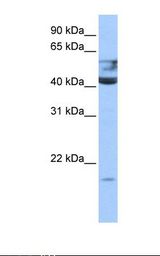 QTRT1 Antibody - Fetal brain cell lysate. Antibody concentration: 0.5 ug/ml. Gel concentration: 12%.  This image was taken for the unconjugated form of this product. Other forms have not been tested.