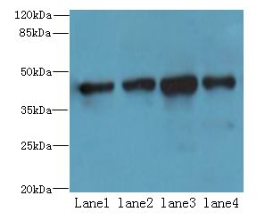 QTRT1 Antibody - Western blot. All lanes: RSPO3 antibody at 6 ug/ml. Lane 1: MCF7 whole cell lysate. Lane 2: PC-3 whole cell lysate. Lane 3: Jurkat whole cell lysate. Lane 4: A431 whole cell lysate. Secondary Goat polyclonal to Rabbit IgG at 1:10000 dilution. Predicted band size: 44 kDa. Observed band size: 44 kDa.