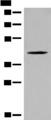 QTRT1 Antibody - Western blot analysis of Jurkat cell lysate  using QTRT1 Polyclonal Antibody at dilution of 1:450
