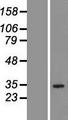 QTRT1 Protein - Western validation with an anti-DDK antibody * L: Control HEK293 lysate R: Over-expression lysate