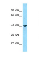QTRTD1 Antibody - QTRTD1 antibody Western blot of Mouse Liver lysate. Antibody concentration 1 ug/ml.  This image was taken for the unconjugated form of this product. Other forms have not been tested.