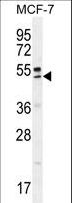 QTRTD1 Antibody - QTRTD1 Antibody western blot of MCF-7 cell line lysates (35 ug/lane). The QTRTD1 antibody detected the QTRTD1 protein (arrow).