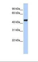 QTRTD1 Antibody - Fetal heart lysate. Antibody concentration: 1.0 ug/ml. Gel concentration: 12%.  This image was taken for the unconjugated form of this product. Other forms have not been tested.